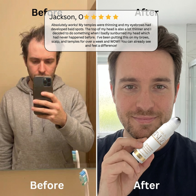 Customer applying the roll-on